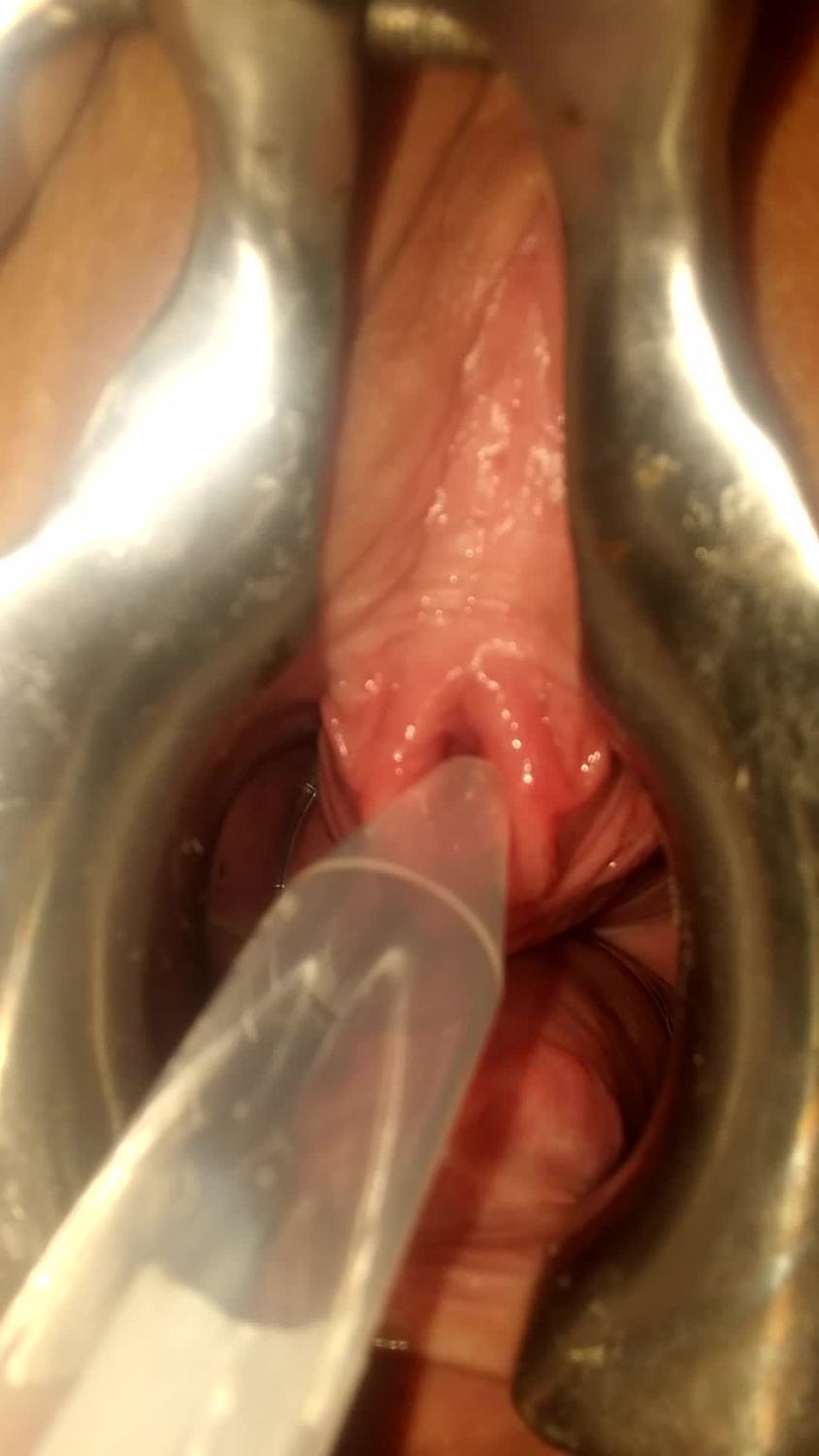 peehole play